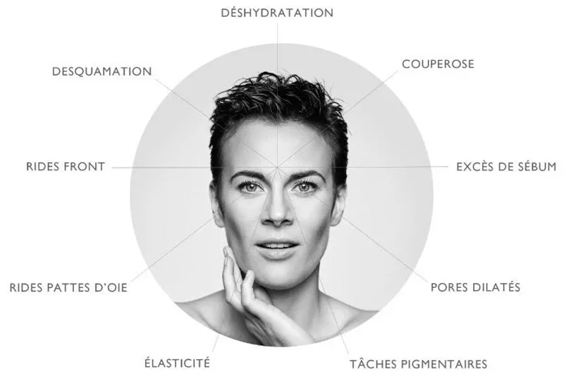 Photo : Belle Pour Soi, Institut de beauté - santé de la peau - rajeunissement à Mettet