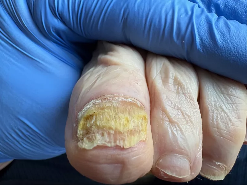 Photo : Basseilles Christophe, Pédicure médicale à Andenne