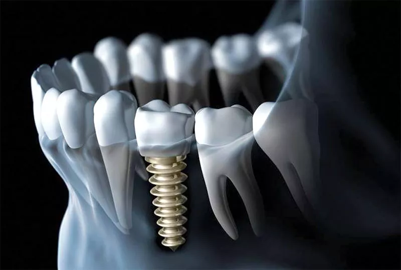 Photo : Laboratoire Dentaire Crickx, Laboratoires dentaires à Saint-Ghislain